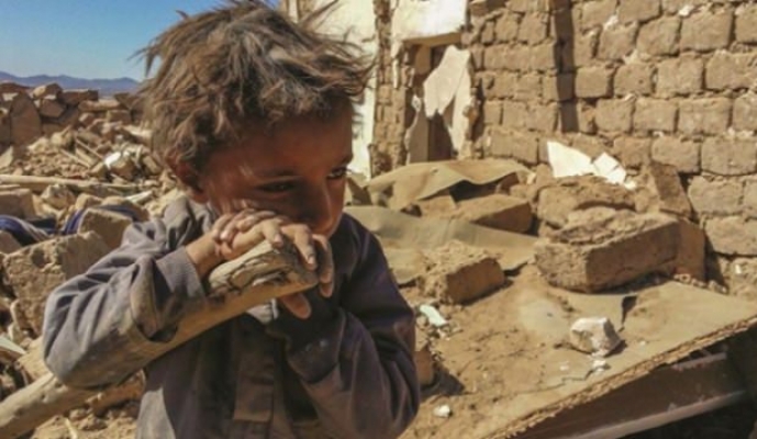 “Yemen'de ölüm sınırında 400 bin bebek ve çocuk var“