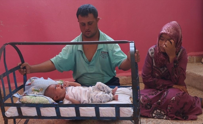 Suriye'de 'mucize bebek' yardım bekliyor