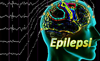 Epilepsiye pilli kontrol